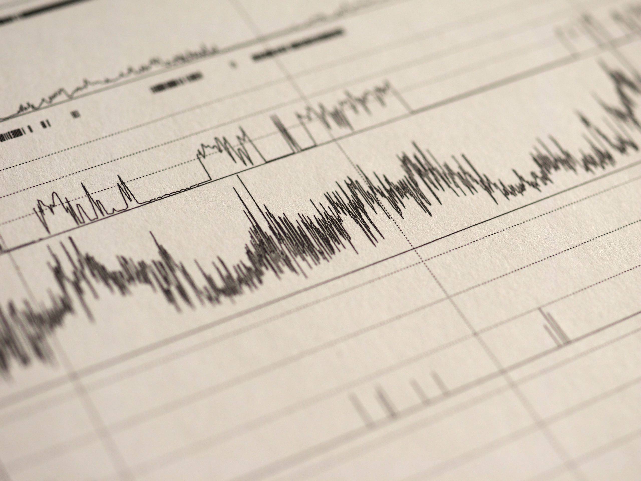 Polysomnography Workshop